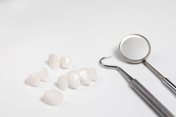 istock Dental tools and tooth implant isolated on white background 938088536