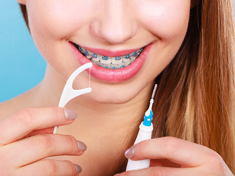 Oral hygiene concept. Woman with braces cleaning teeth with toothbrush and dental floss