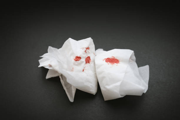istock White napkin with blood. 938556162