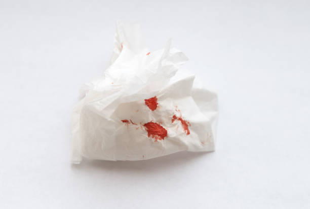 istock White napkin with blood. 938556320