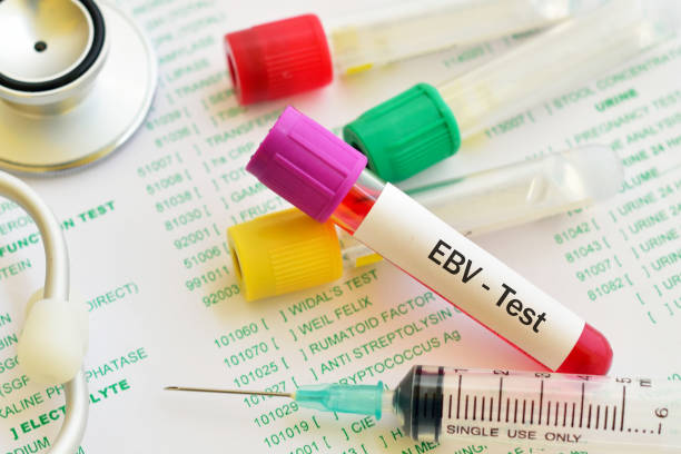 Epstein-Barr virus (EBV) test Test tube with blood sample for Epstein-Barr virus (EBV) test epstein barr virus photos stock pictures, royalty-free photos & images