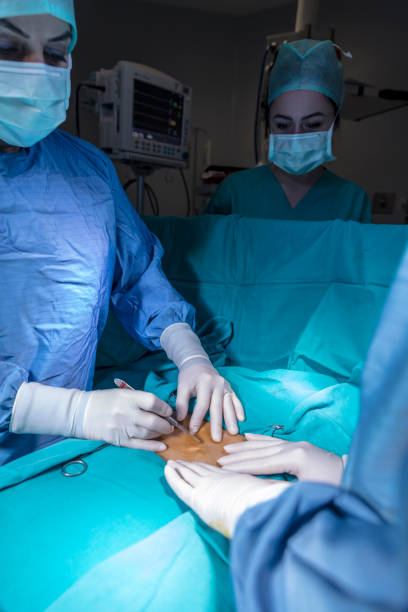 istock Concentrating surgeons performing operation in operating room 938736806