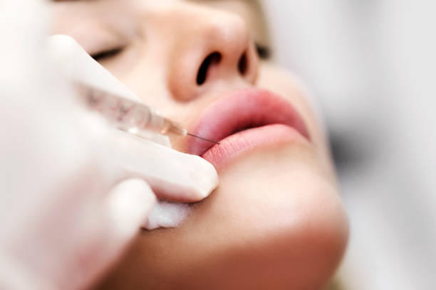 cosmetóloga profesional inyectando silicona en labios - attractive female human collagen syringe injecting fotografías e imágenes de stock