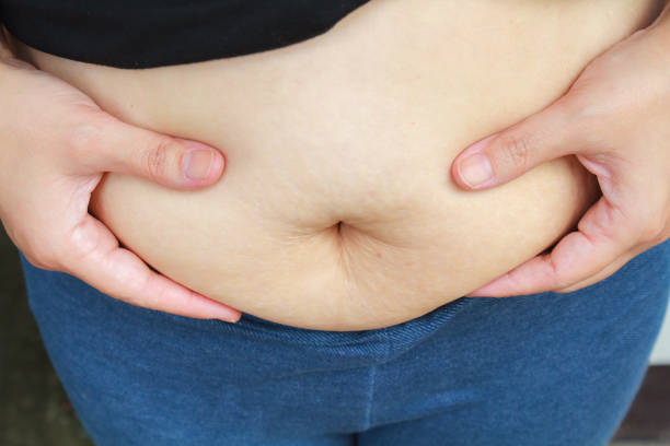 istock Girl paunchy fat 938911512