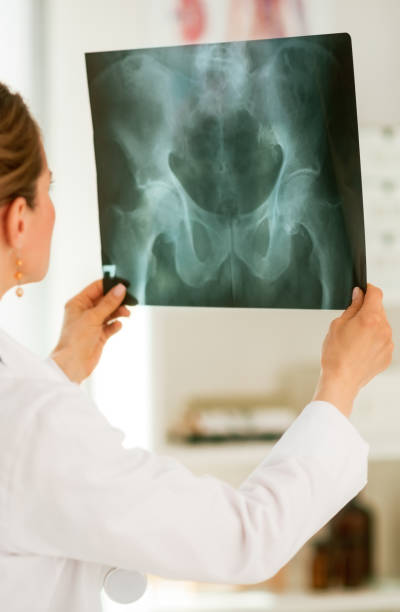 istock Doctor woman looking on fluorography. rear view 939239274