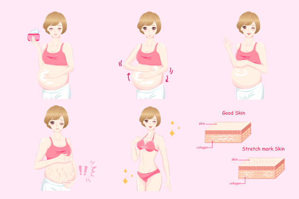 pregnant women with stretch marks cartoon pregnant women with stretch marks on the pink background Stretch Mark Cream stock illustrations