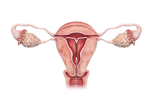 dispositivo intrauterino renderizado 3d. - vagina contraceptive gynecologist doctor fotografías e imágenes de stock
