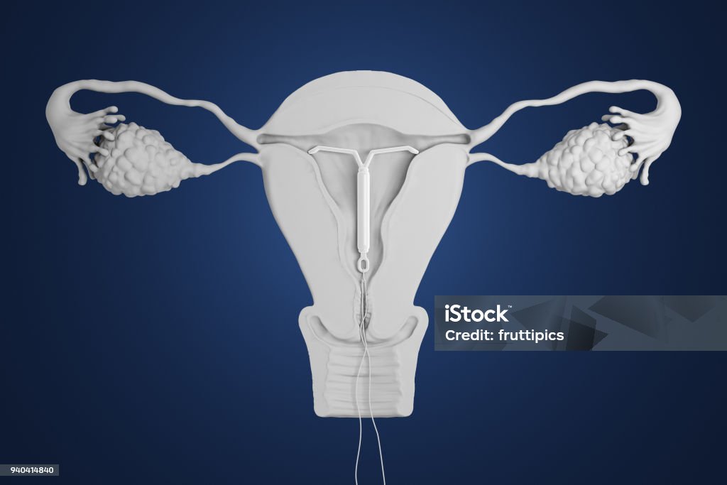 3d rendered intra-uterine device. 3d rendered illustration of an intra-uterine device. IUD Stock Photo