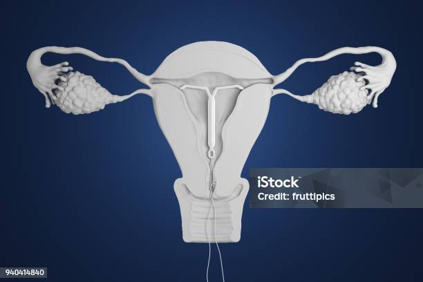 3d Rendered Intrauterine Device Stock Photo - Download Image Now - IUD, Hormone, Contraceptive