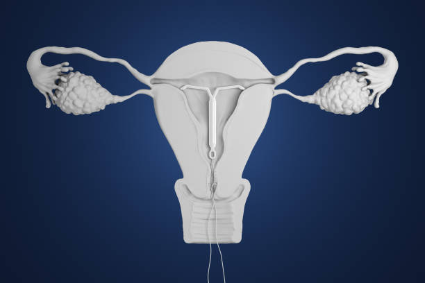 3d визуализирован внутриматочное устройство. - vagina contraceptive gynecologist doctor стоковые фото и изображения