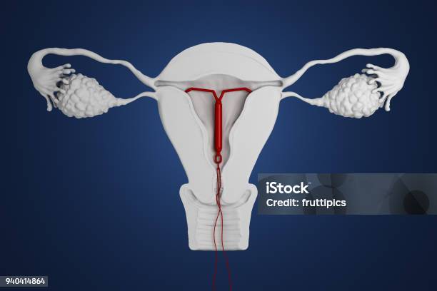 Photo libre de droit de 3d Rendu Dispositif Intrautérin banque d'images et plus d'images libres de droit de Stérilet - Stérilet, Ordre, Contraceptif