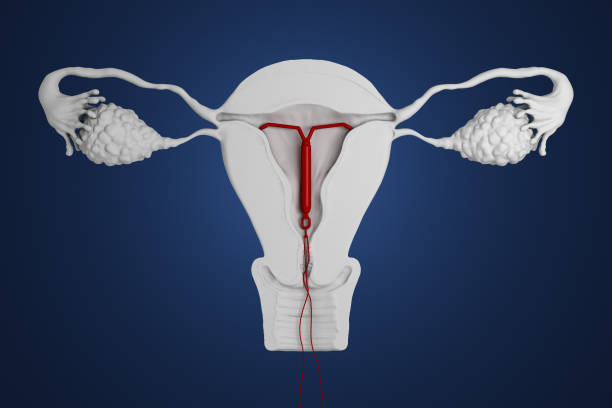 3d rendered intra-uterine device. stock photo