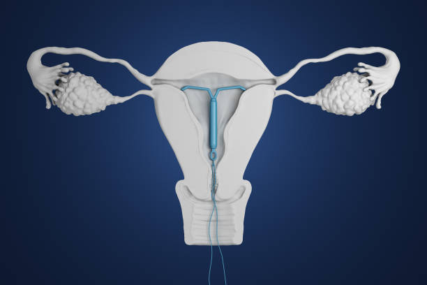 dispositivo intrauterino renderizado 3d. - vagina contraceptive gynecologist doctor fotografías e imágenes de stock