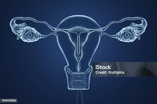 3d Rendered Illustration Of An Xray Of The Uterus Stock Photo - Download Image Now