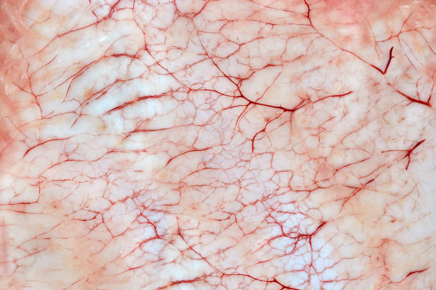 피부에 피 묻은 염증 성 모세 혈관 - capillary 뉴스 사진 이미지