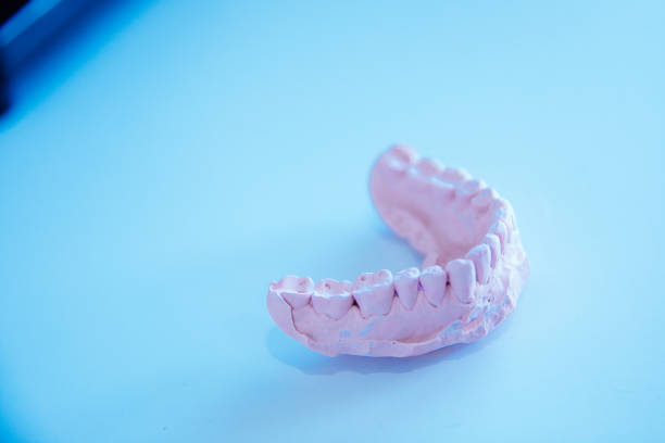 istock dental molds of human teeth 940518622