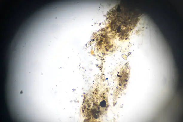 Mosquito larva W.M. under microscopy
