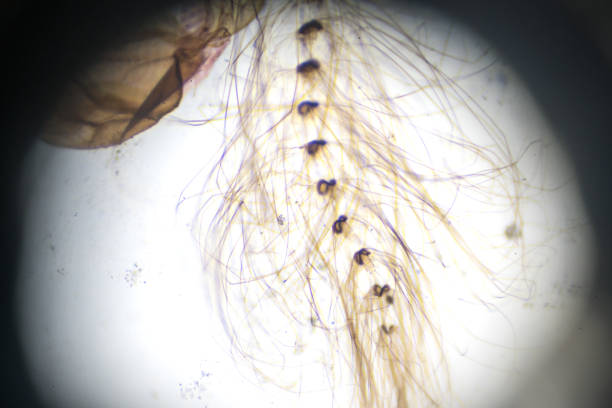 The Insect Sect 580+ Microscopic Image Of Insect Section Stock Photos, Pictures ...