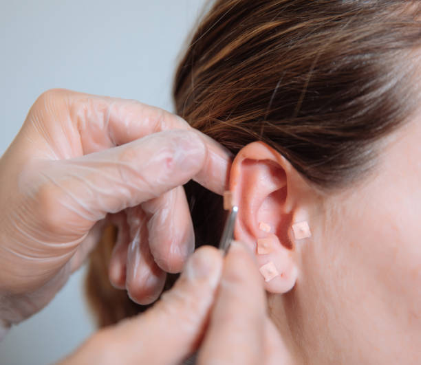 врач положить иглоукалывание иглы в ухо - chiropractic adjustment osteopath back physical therapy стоковые фото и изображения