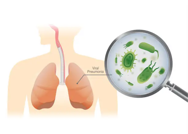 Vector illustration of Finding virus in the human lung with a magnifier.