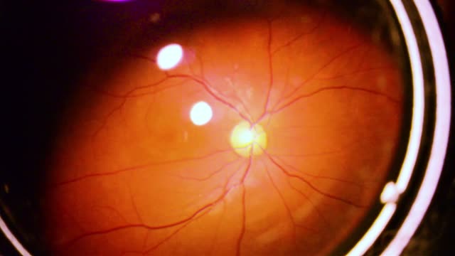 Human eye iris contracting