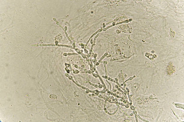 pseudohyphae och spirande jäst celler i urin - klamydiatest bildbanksfoton och bilder