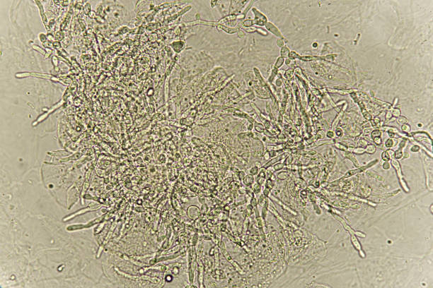 istock Pseudohyphae and budding yeast cells in urine 941113138