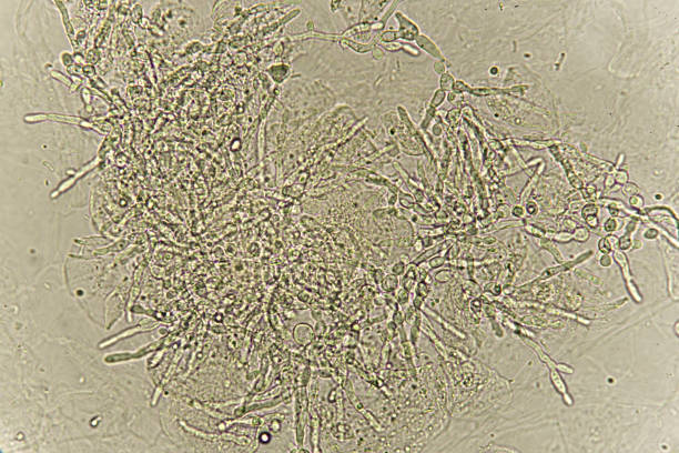 pseudohyphae och spirande jäst celler i urin - klamydiatest bildbanksfoton och bilder