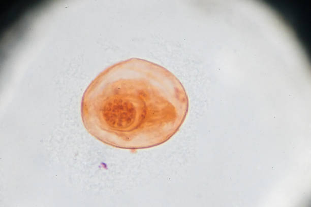 istock Eggs of Taenia solium W.M. under light microscopy 941183926