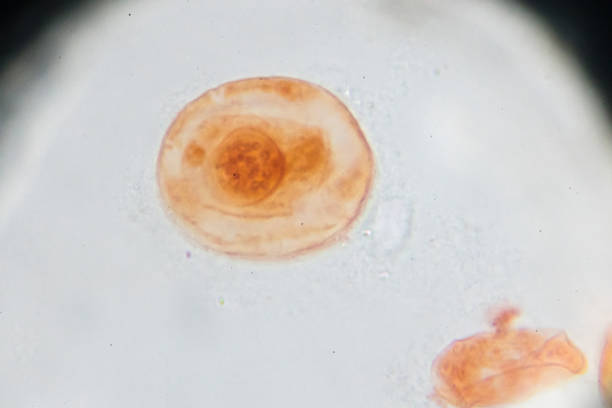 istock Eggs of Taenia solium W.M. under light microscopy 941184206