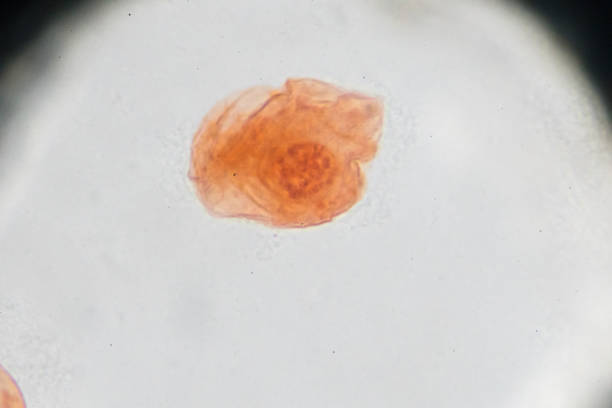 istock Eggs of Taenia solium W.M. under light microscopy 941186610