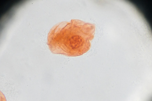 Eggs of Taenia solium W.M. under light microscopy