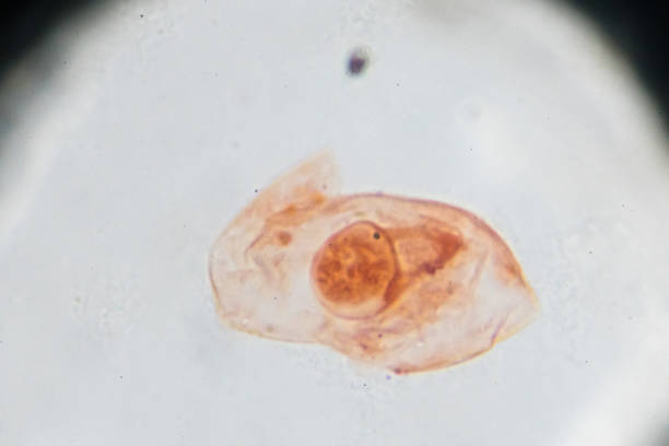istock Eggs of Taenia solium W.M. under light microscopy 941189794