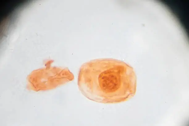 Eggs of Taenia solium W.M. under light microscopy