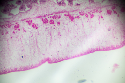 Taenia Pisiformis Section under light microscopy