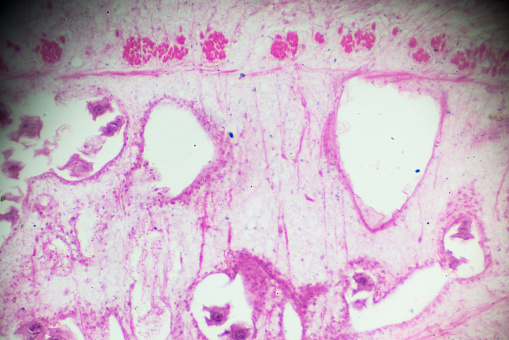 Taenia Pisiformis Section under light microscopy