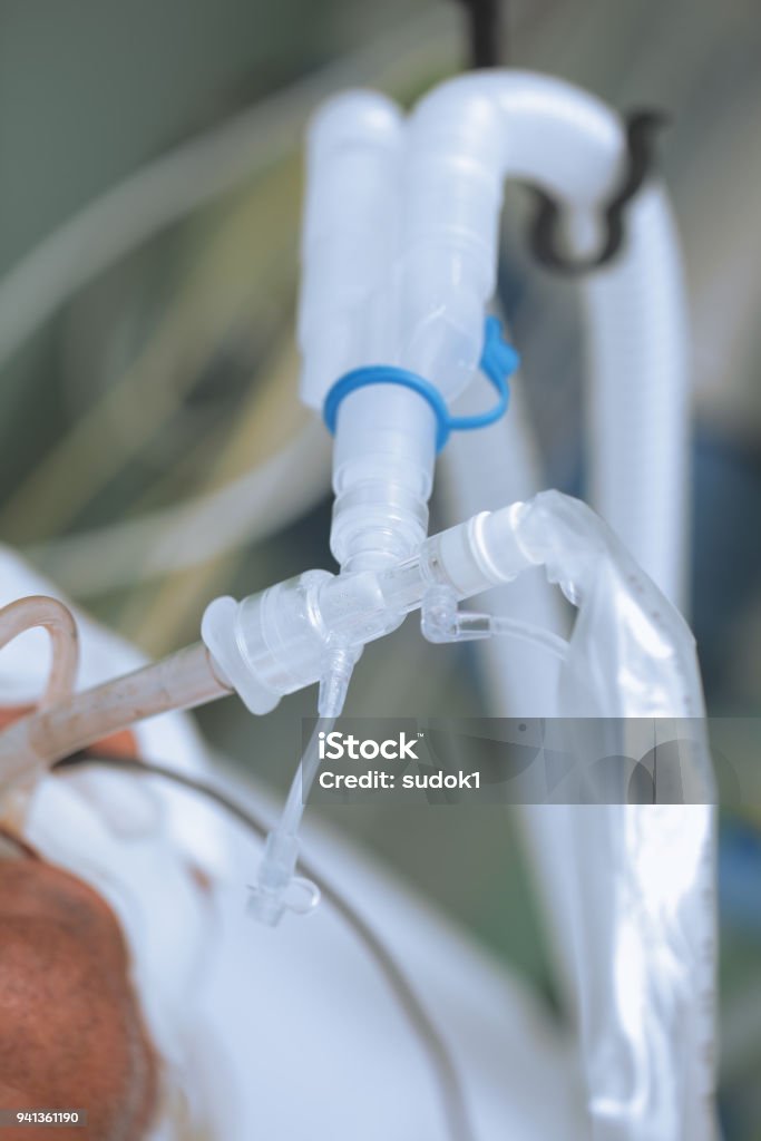 Lung ventilation equipment of the patient Lung ventilation equipment of the patient. Patient Stock Photo