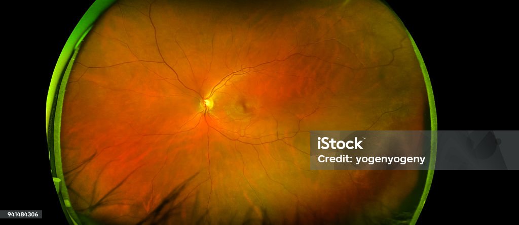 eye's retinal angle image with macula, vessels and optic disc isolated view on a black bacground. made by ultra wide fundus camera Retina Stock Photo
