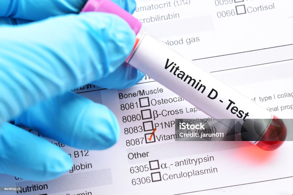 Vitamin D test Test tube with blood sample for vitamin D test Vitamin D Stock Photo