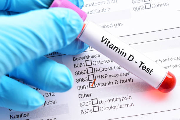 Vitamin D test stock photo