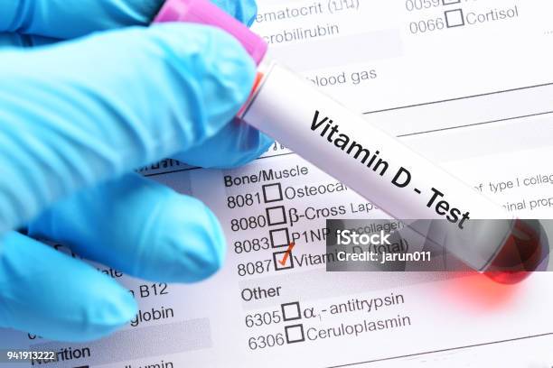 Vitamin D Test Stock Photo - Download Image Now - Vitamin D, Scientific Experiment, Calcium