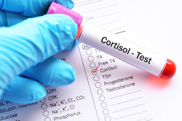 Cortisol hormone test Blood sample for cortisol hormone test Cortisol stock pictures, royalty-free photos & images