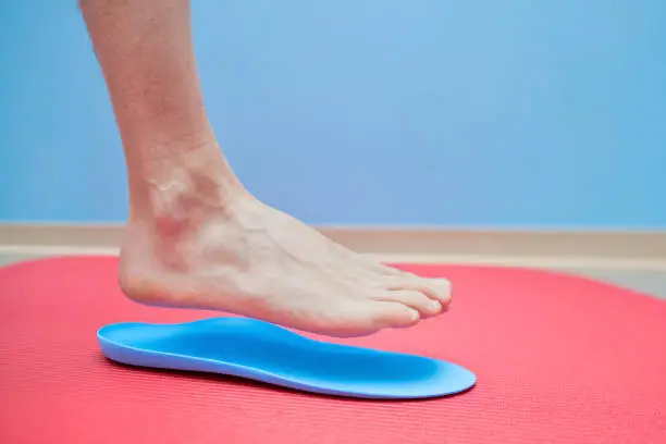Foot on orthopedic insoles medical foot correction.