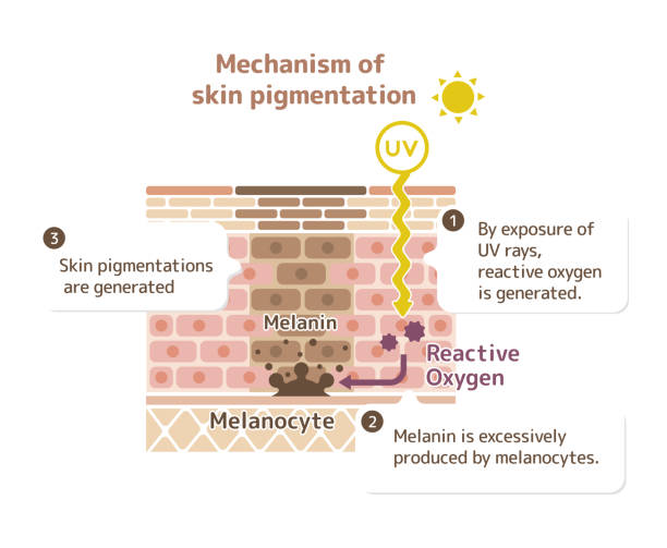 механизм пигментации кожи / иллюстрация пятна кожи (с объяснением) - melanocyte stock illustrations