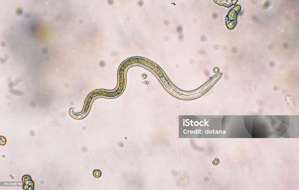 Toxocara Canis segunda etapa larvas Portilla desde huevos - Foto de stock de Parásito libre de derechos