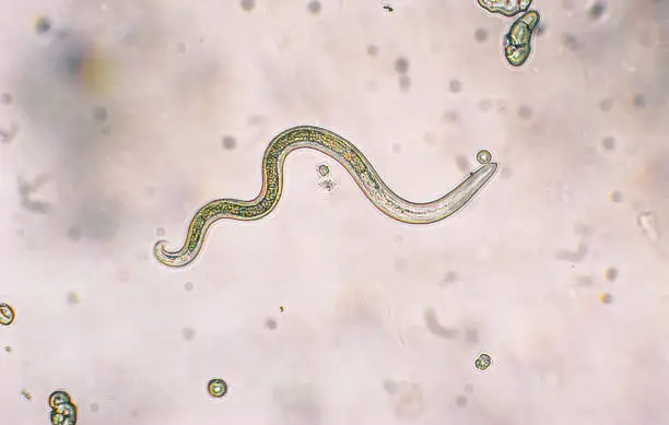 Toxocara canis second stage larvae hatch from eggs in microscope. Toxocariasis, also known as Roundworm Infection, causes disease in humans