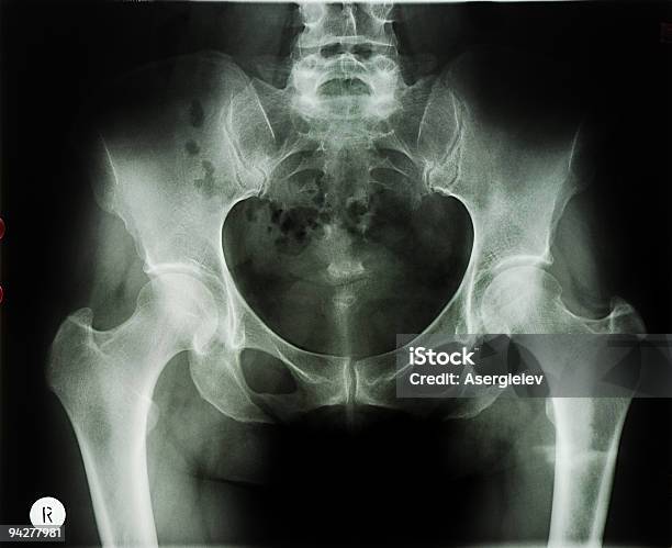 Corpo Humano De Radiografia - Fotografias de stock e mais imagens de Anatomia - Anatomia, Articulação - Parte do corpo, Articulação humana
