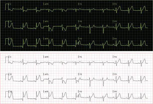 ilustraciones, imágenes clip art, dibujos animados e iconos de stock de real ecg (vector - pulse trace taking pulse computer monitor healthcare and medicine