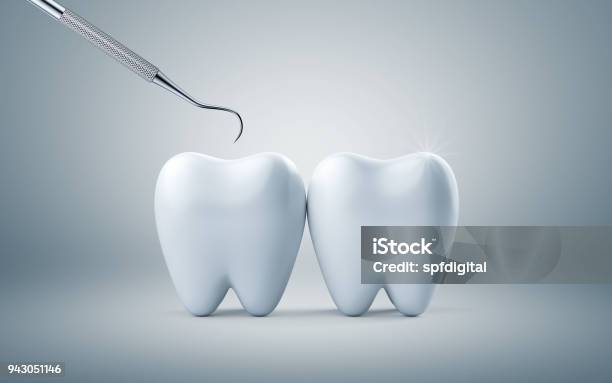 Photo libre de droit de Dents Avec Outil De Plaque Dentaire Dental Concept Soin Nettoyage Plaque Bactérienne Sur Fond Blanc Rendu 3d banque d'images et plus d'images libres de droit de Dents