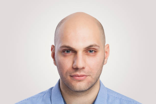 istock Bald man head shot looking at camera with blank facial expression 943400810